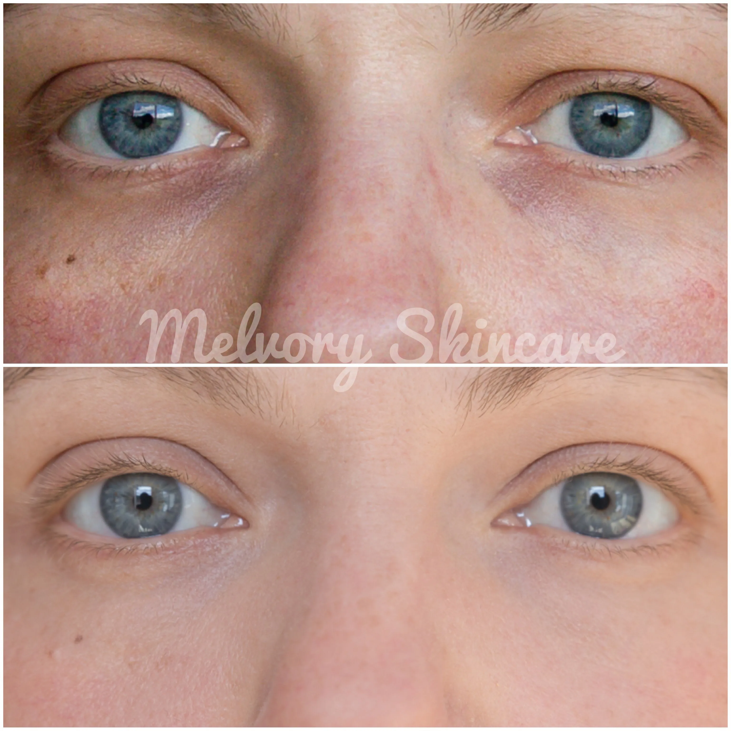 Eye Am Not Tired Duo